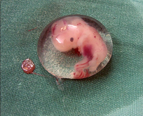 embryon à 6 semaines de grossesse